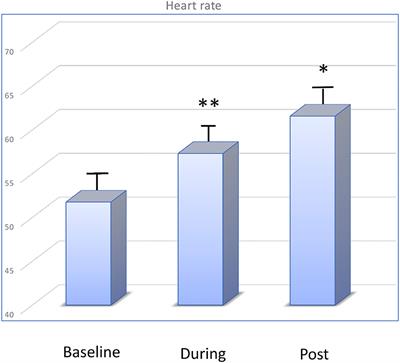 Cardiovascular Effects of Whole-Body Cryotherapy in Non-professional Athletes